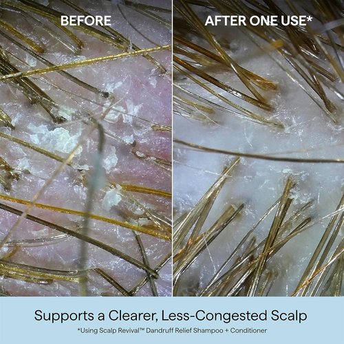 Briogeo Scalp Revival Dandruff Relief Shampoo - Charcoal & 3% Salicylic Acid | Color-Safe & Vegan | 8.4 fl oz
