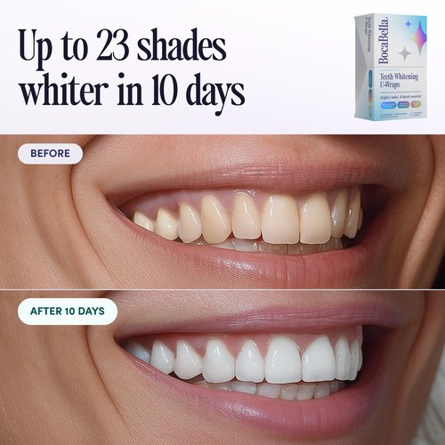 Boca Bella Teeth Whitening U-Wraps – 10 Treatments – 15% Hydrogen Peroxide, Enamel-Safe, No Harsh Sensitivity – Patented Strip Design with Aloe, Calendula & Peppermint – Fast, Even Whitening