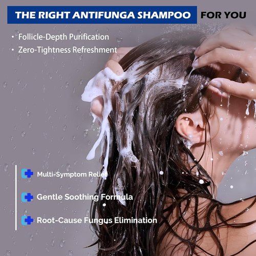 Skiennix Antifungal Psoriasis Shampoo - Relieves Scalp Itching & Dryness | 10.1 Fl Oz, Sulfate-Free