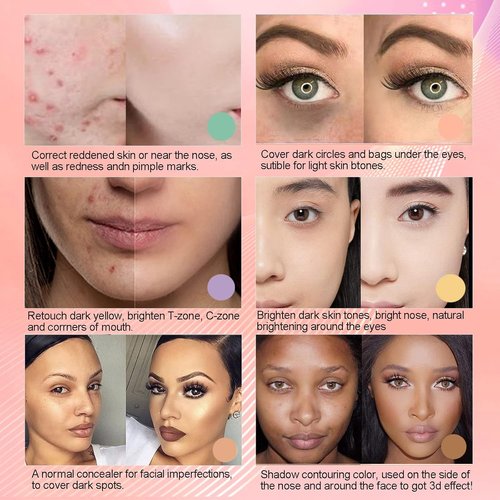 Skiennix Color Corrector Palette - 6-in-1 Concealer & Contour Kit for Dark Circles & Redness | Full Coverage