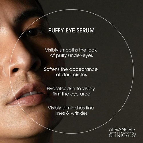 Advanced Clinicals Under Eye Serum - Brightening Vitamin C & Caffeine for Puffiness, Fine Lines & Dark Circles | 1.75 Fl Oz