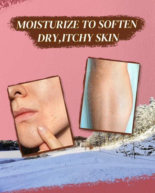 larosanna Australian Lanolin Cream,Natural Lanolin Cream for Itchy Dry Skin,Organic Lanolin Oil Moisturizer for Body and Face,3.53 fl oz