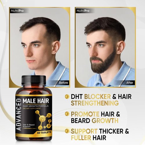 Skiennix Hair Growth Vitamins for Men - DHT Blocker & Biotin Supplement for Thicker, Fuller Hair
