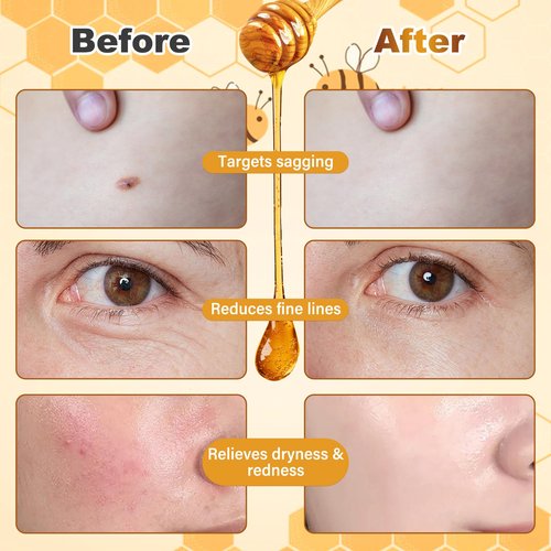 Bee Venom Facial Treatment Cream for Fine Lines & Improving Elasticity, 2.12 OZ (Pack of 2)