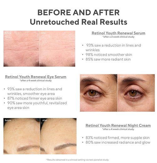 Murad Active Renewal 30-Day Regimen Kit | 5-Piece Trial Set for Youthful Skin - $98 Value