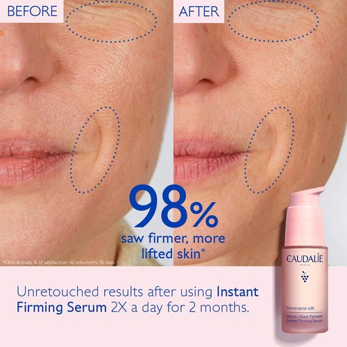 Caudalie Resveratrol-Lift Serum - Instant Firming Retinol Alternative, 30 mL Refill