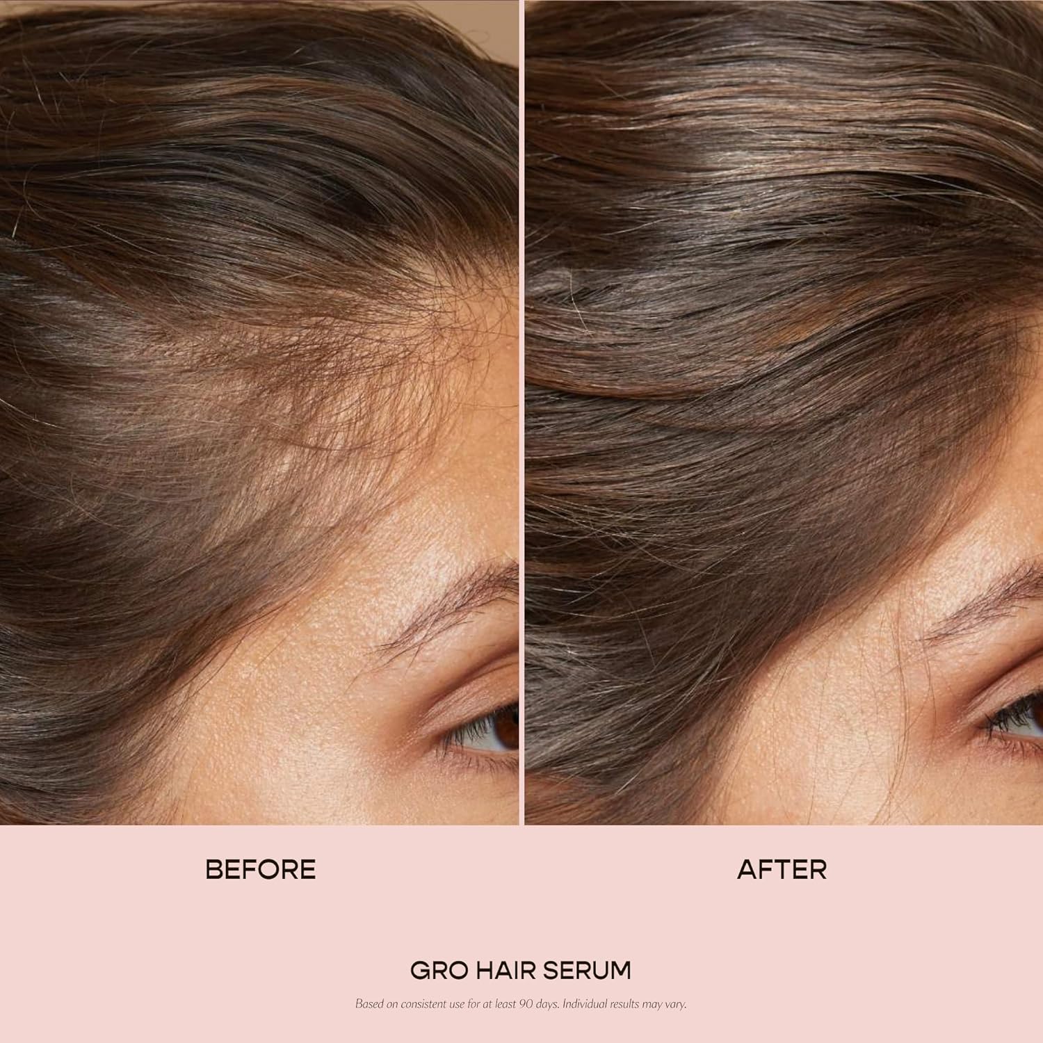 VEGAMOUR GRO Hair Serum - Thicker, Fuller Hair in 90 Days | Non-Oily, Vegan, Bergamot Scented