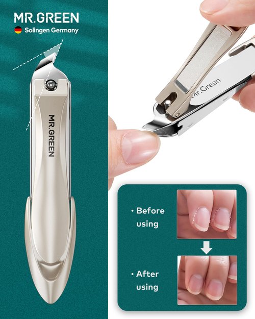 MR.GREEN 4Pcs Nail Clippers Set, Upgraded Anti-Splash Nail Clippers with Nail File and Tweezers, Professional Fingernail Toe Nail Clippers, Portable Manicure Nail Kit with Premium Case for Men& Women