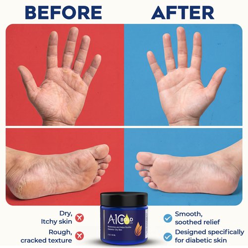 A1C BOLD SKINCARE Diabetic Care Balm - Balm for Diabetics Care with Beeswax & Vitamin E, Diabetic Moisturizer For Dry, Cracked Hands & Feet, Long-Lasting Hydration for Sensitive Skin, 2 oz