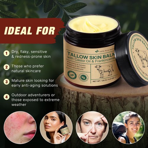 Beef Tallow Balm with Frankincense and Castor oil 4.2 fl.oz, 100% Grass-Fed Tallow for Skin Care, Face & Body Moisturizer for Skin Hydrating & Nourishing, Sensitive Skin & Dry Skin Age Defying
