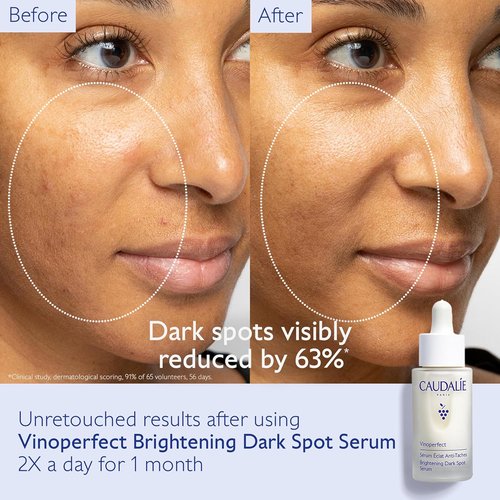 Caudalie Vinoperfect Dark Spot Serum - Brightening Formula with Travel Size Grape Water Mist