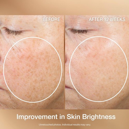 StriVectin Multi-Action Super C Retinol Serum - Brightening & Correcting Formula 1 oz