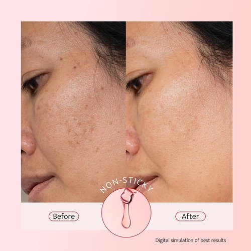 Bestkiss 10% Niacinamide + 5% Tranexamic Acid + 2% Alpha-Arbutin Dark Spot Serum with Ceramides Hyaluronic Acid Centella Asiatica - Korean Glass Skin Vegan Paraben Fragrance Cruelty Free 1 FL OZ/30mL