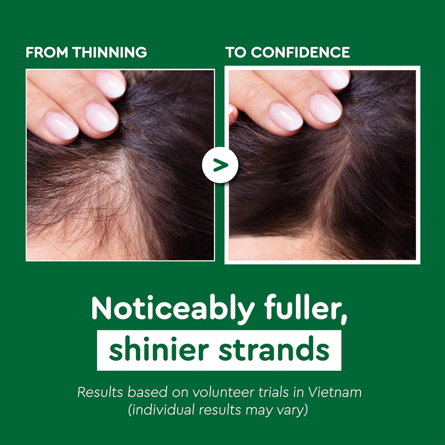VIETNAM Hair Growth Shampoo - Strengthens Thinning Hair with Polygonum Multiflorum | 14.8 oz