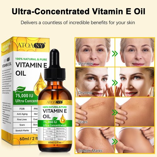 flasture Vitamin E Oil 75,000 IU – 100% Pure Natural Vitamin E for Skin, Face, Hair, Scars – Deep Moisturizing Body Oil for Dry Skin, Wrinkles – Cold-Pressed, Non-GMO,Skincare – 2 Fl Oz