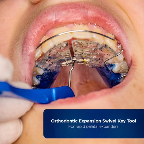 Galvanox Dental Orthodontic Expansion Swivel Key Tool for Palatal Expanders (6 Pack)