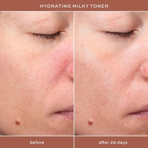 ITK Hydrating Hyaluronic Acid Milky Face Toner for Dry Skin + Redness with Green Tea + Squalane - Prep, Tone + Calm Skin for Women - Soothing Vegan Moisturizing Facial Toner - 5 oz.