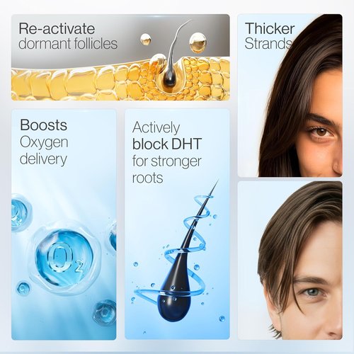 Be Bodywise Rosemary Hair Growth Serum - 3% Rosemary & Redensyl | DHT-Blocking Roll-On for Hair Fall | 50 ml | Paraben/Sulfate-Free