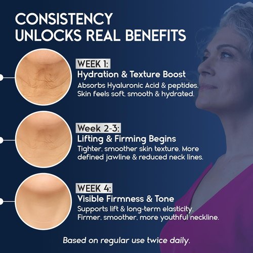 Skiennix Neck Cream - Firming & Tightening for Sagging Skin | Anti-Aging Treatment with Collagen & Hyaluronic Acid