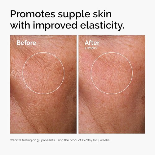 The Ordinary Serum Favorites Set - Hydrating Hyaluronic Acid 2% + B5, Brightening Niacinamide 10% + Zinc 1%, Caffeine Solution 5% | Eye & Face Care