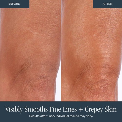 SKINN Anti-Aging Luminous Body Butter for Dry Skin - Long Lasting Ultra Moisturizing Cream for Dryness, Dullness & Rough Skin Texture - Quick-Absorbing & Non-Greasy with Vitamin C & Manuka Honey