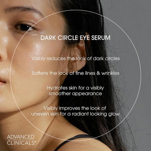 Advanced Clinicals Under Eye Serum - Caffeine & Hyaluronic Acid for Dark Circles | Brightening Vitamin C, 1.75 Fl Oz