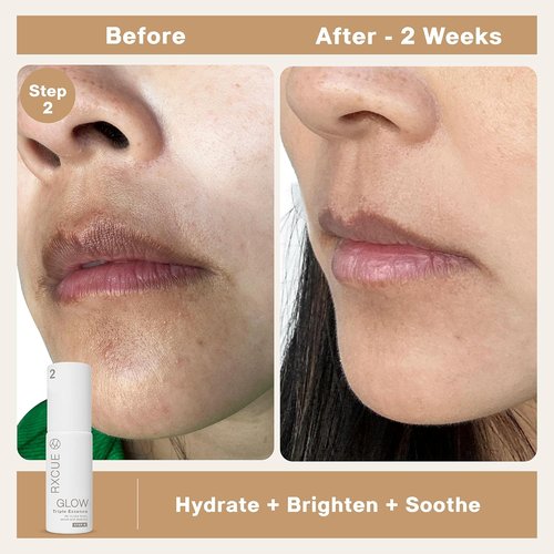 Rxcue Korean Skincare Set - 3-Step Travel Size K-Beauty Kit for Glass Skin | TSA Approved, 1.01 fl oz Each
