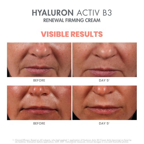 Avène Hyaluron Activ B3 Firming Cream - Renew Skin's Youthful Glow | 1.7 oz