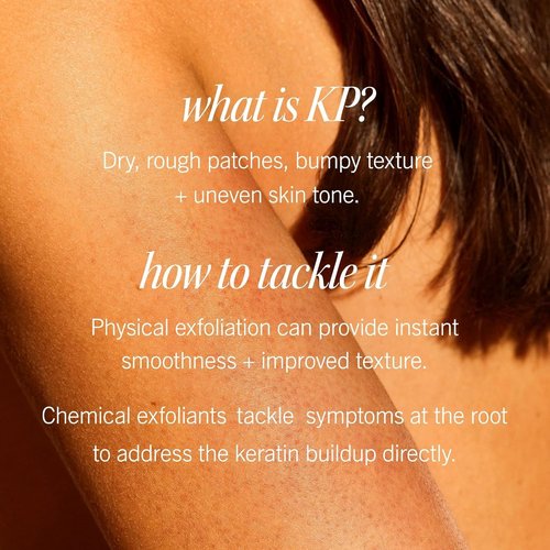 First Aid Beauty - KP Bump Eraser Body Scrub | 10% AHA Exfoliator for Keratosis Pilaris, Peach Scent (2 oz)