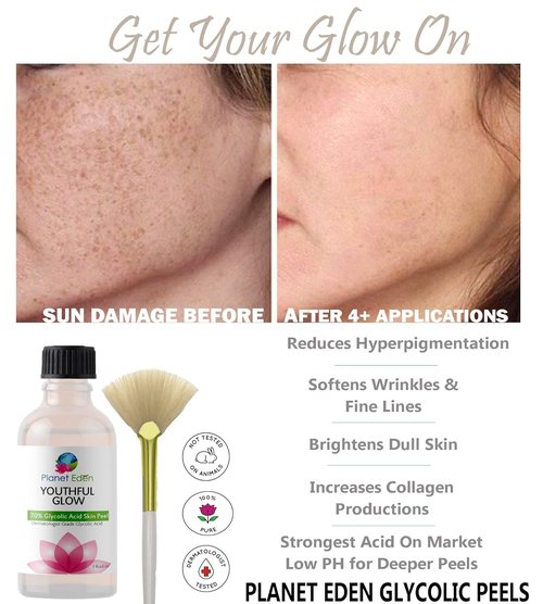 Glycolic Acid Peel 40% - Deep Skin Resurfacing AHA Exfoliant for Smooth Texture & Radiant Glow