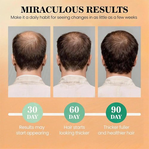 Dr Sebi Batana Oil - 100% Raw Organic Hair Growth Mask | Promotes Thickness & Prevents Loss, 2 Fl Oz