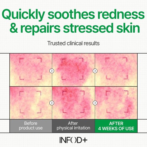 INFODPLUS Korean Skin Care Sensitive Face Cream, Lightweight Moisturizer with Ceramides & Panthenol, Skin Barrier Support & Deep Hydration, Low pH Daily Cream for AM/PM Use, 50ml