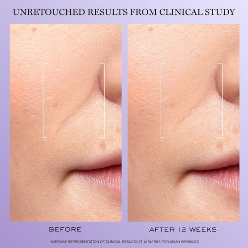 Lancôme Rénergie H.C.F. Triple Serum - Anti-Aging Hyaluronic Acid Formula with Vitamin C+, Niacinamide & Ferulic Acid