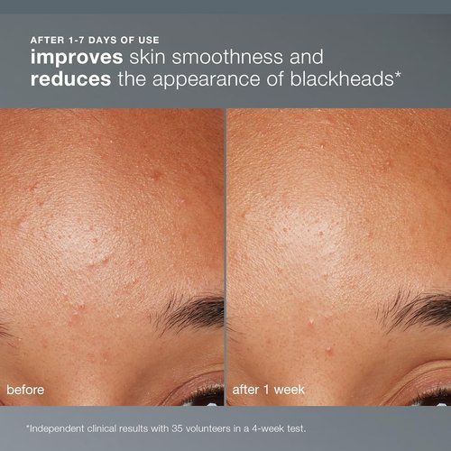 Dermalogica Daily Microfoliant - Exfoliating Face Scrub Powder with Salicylic Acid & Papaya Enzyme for Brighter Skin