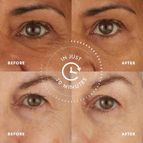 Skyn ICELAND Hydro Cool Firming Eye Gel Patches - Reduce Dark Circles & Puffiness | 4 Pairs