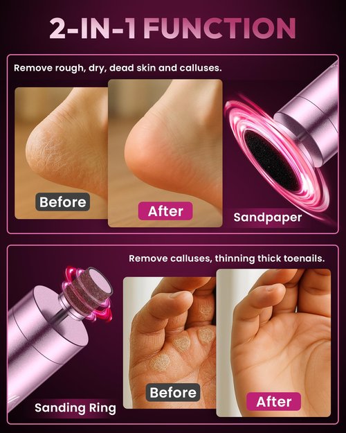 AWROSE Callus Remover for Feet, Cordless Electric Foot Callus Remover with Rechargeable 2600mAh High-Capacity, 6.2IN Aluminum Foot File,Professional Pedicure Tools for Dead/Hard/Dry Skin&Cracked Heels