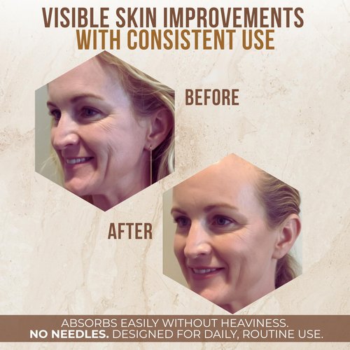 Bee Venom Skin Treatment Cream | Face & Neck Wrinkle Moisturizer That Firms & Tightens | Made In USA | Hydrating Skin Restoration with Instant Smoothing Effect