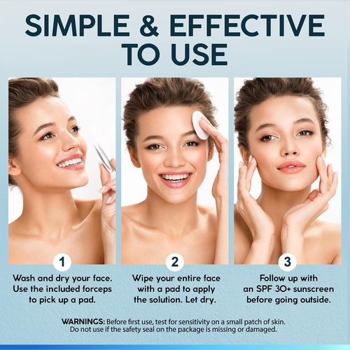 NUVADERMIS 35% Glycolic Acid Peel Pads - Exfoliating Facial Resurfacing for Blackheads & Dark Spots - 60 Double-Sided Pads