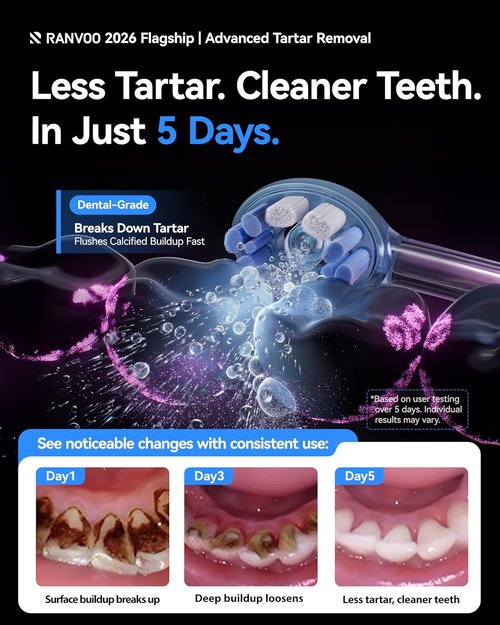 RANVOO AirJet X5 Electric Toothbrush - New-Gen Jet Clean for Maximum Tartar Removal | 60-Day Battery Life, Pale Violet