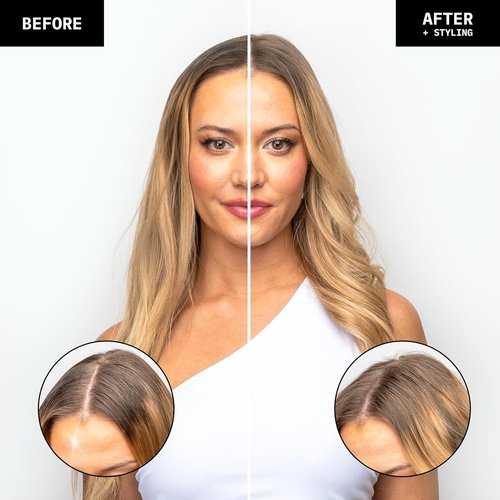FoxyBae Overnight Dry Shampoo Spray - Biotin & Charcoal Formula for Oil Control - 7 fl oz