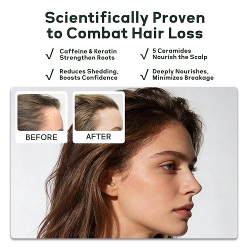 Skiennix Gentle Hydrating Shampoo - Sulfate & Silicone Free Formula for Sensitive Skin | Vegan & Paraben-Free