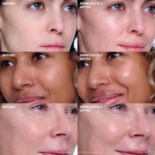 Peter Thomas Roth | Collagen Skinjection™ Plumping & Firming Serum | Exosome & Peptide Infusion for Youthful Skin