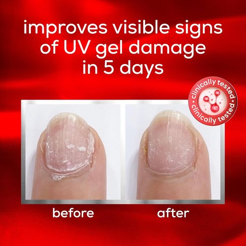 Essie Nail Care - UV Gel Damage Repair Treatment | To The Rescue Nail Repair Base Coat, 0.46 Fl Oz