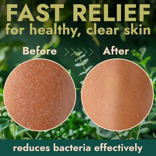 Antibacterial Body Wash by [Brand Name] - Kills 99.9% of Germs | Manuka Honey & Charcoal, 16 fl oz