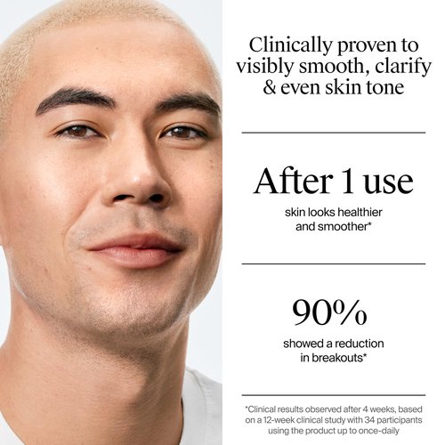 Neutrogena Evenly Clear Acne Exfoliant with Salicylic Acid & Mandelic Acid, Multi-Acid Face Exfoliating Treatment Serum Visibly Fade the look of Post-Acne Marks for A Smooth, Even Skin Tone, 1 fl. oz