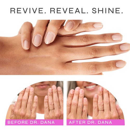 Dr. Dana Nail Repair Kit for Damaged Nails – Strengthening & Exfoliating Treatment with Glycolic Acid, Nail Primer, Hydrator & Priming Wand for Shiny, Healthy Nails, Nail Care Kit