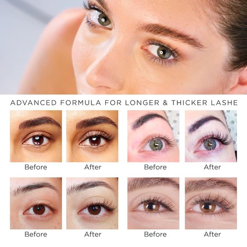 Skiennix Natural Vine Eyelash Growth Serum - Advanced Formula for Longer, Fuller Lashes | Vegan & Cruelty-Free, 3mL