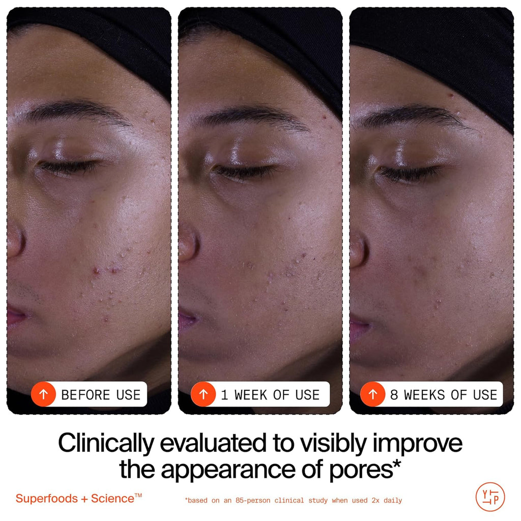 Youth To The People Superfruit Facial Cleanser - Gentle Exfoliating Face Wash with Papaya & Vitamin C for Radiant Skin | AHA + BHA Formula, Sulfate-Free
