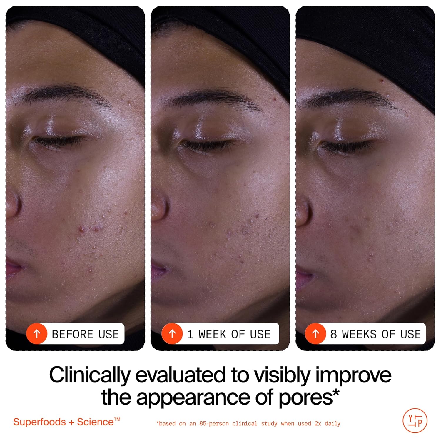 Youth To The People Superfruit Facial Cleanser - Gentle Exfoliating Face Wash with Papaya & Vitamin C for Radiant Skin | AHA + BHA Formula, Sulfate-Free
