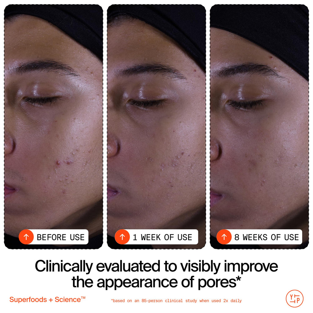 Youth To The People Superfruit Facial Cleanser Full Size - Papaya + Vitamin C Exfoliating Face Wash, Skin Renewal with AHA + BHA, Evens Tone & Texture for Soft + Radiant Skin - 5 fl oz